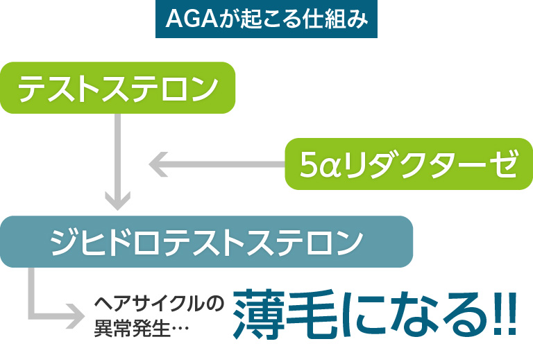 福島・本宮市の薄毛治療アークAGAクリニックがAGA・薄毛になる仕組みを解説